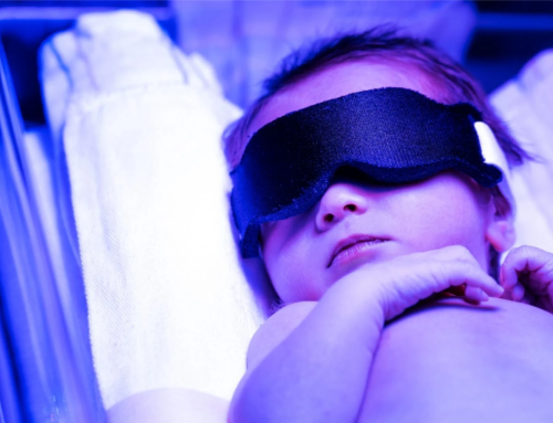 Νεογνικός ίκτερος: Ο συνήθης «ύποπτος» – Όλα όσα θα ήθελαν να μάθουν οι νέες μητέρες